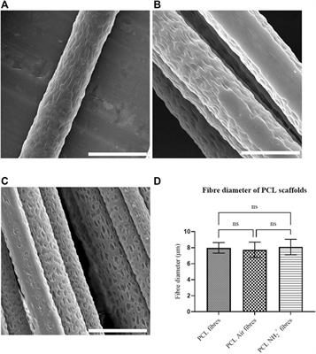 Bioactive 3D Scaffolds for the Delivery of NGF and BDNF to Improve Nerve Regeneration